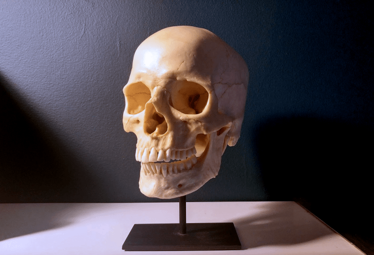 photo of a human skull